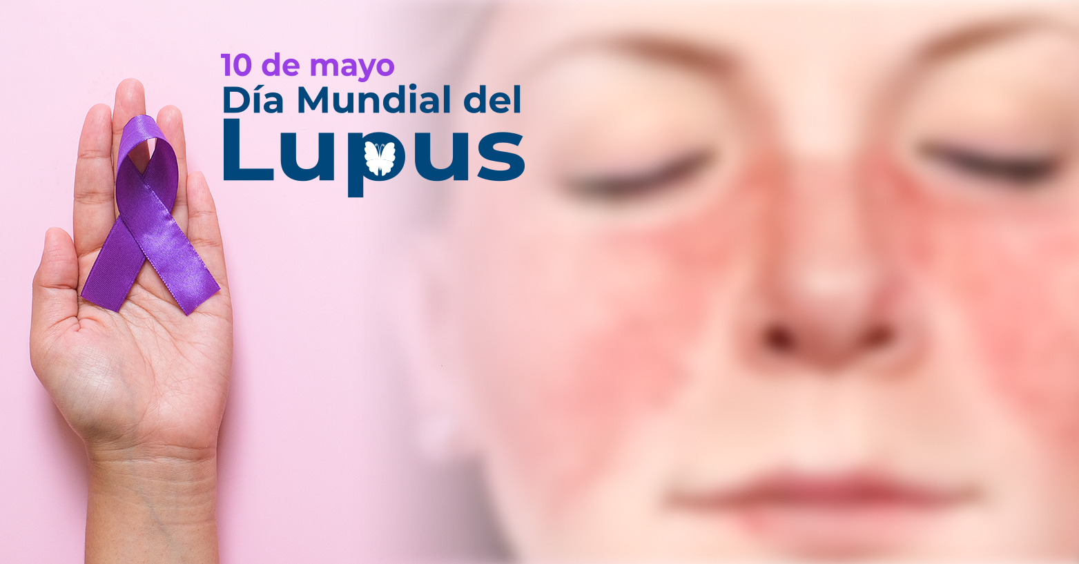 Día Mundial del Lupus | 10 de mayo