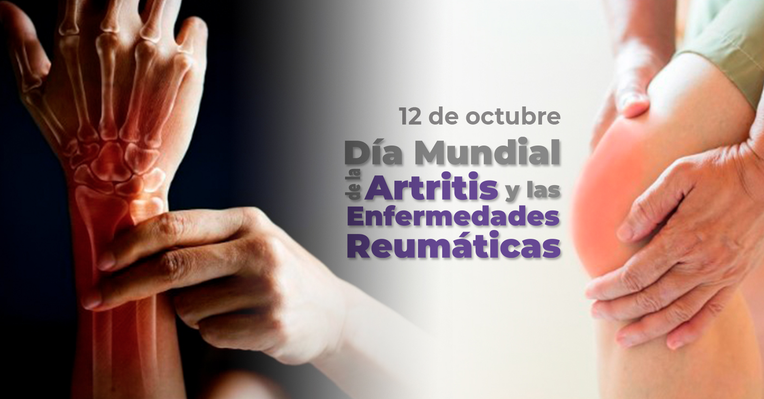 Día Mundial de la Artritis y las Enfermedades Reumáticas | 12 de octubre