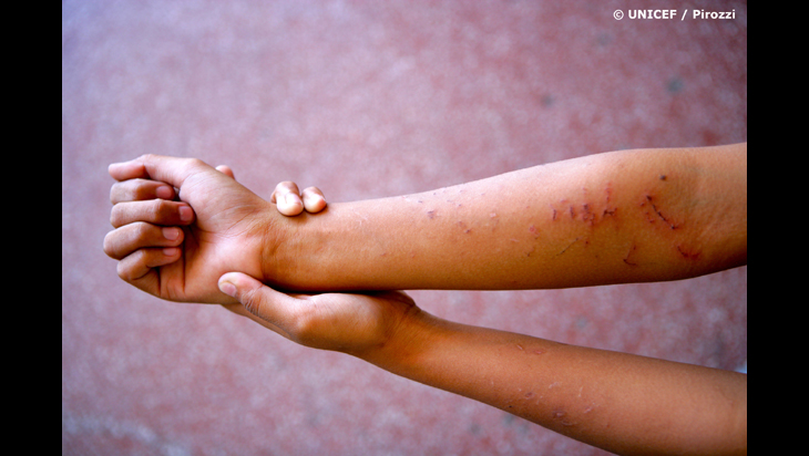 Violencia física afecta gravemente a niñas, niños y adolescentes.