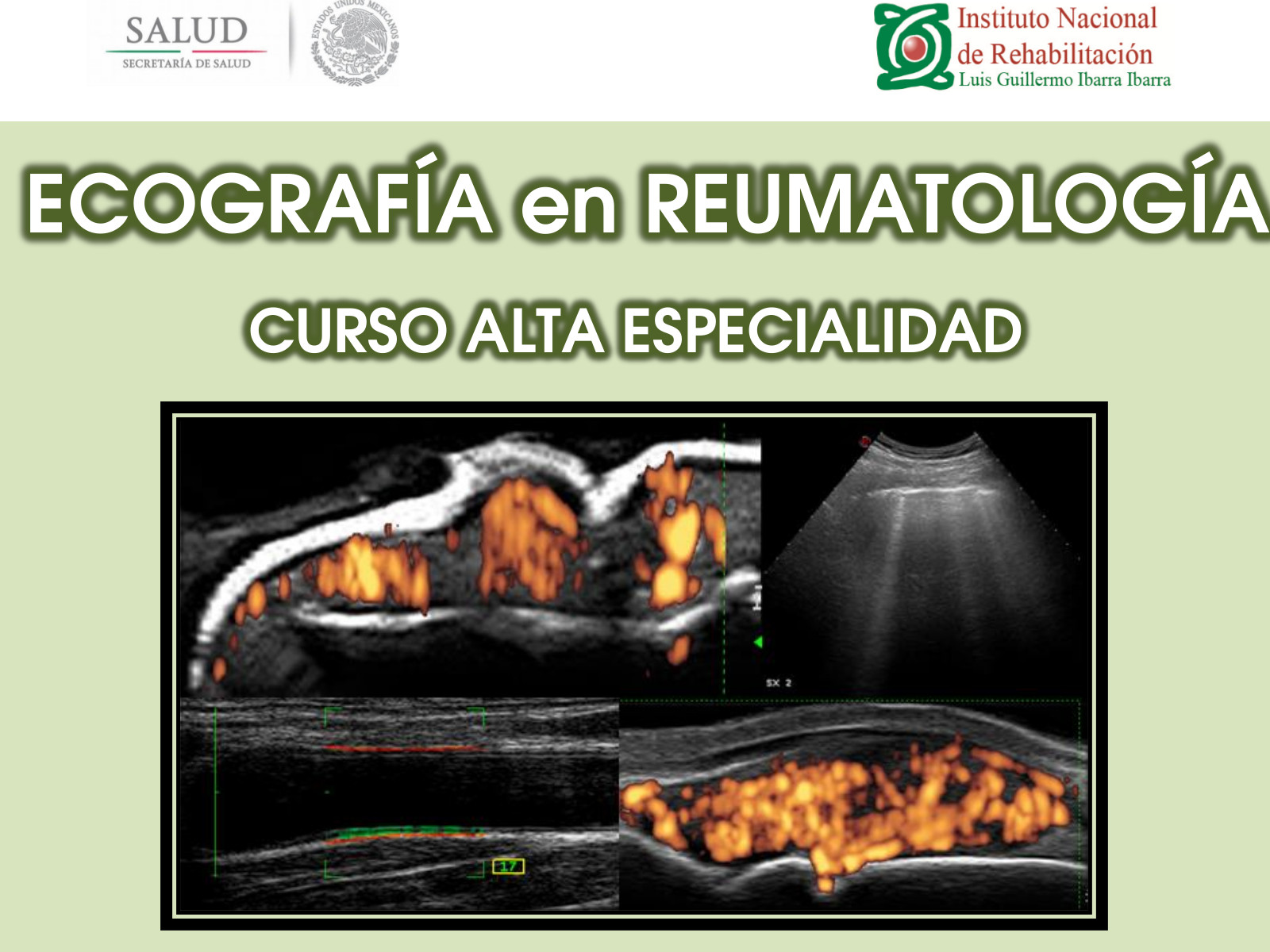 Curso de Alta Especialidad de Ecografía en Reumatología, impartido por el INR