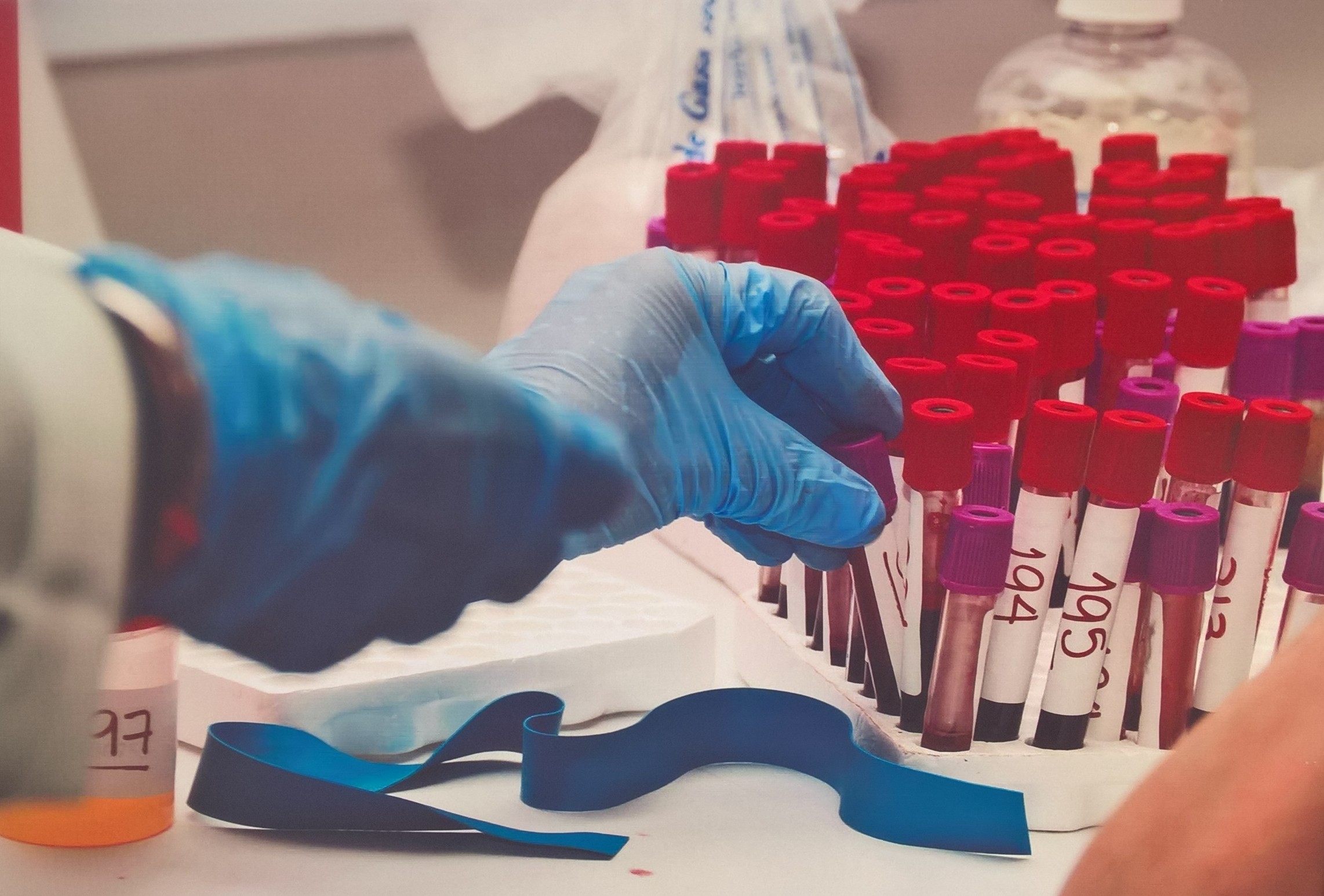 Urge mayor donación de plaquetas para apoyar a pacientes con cáncer