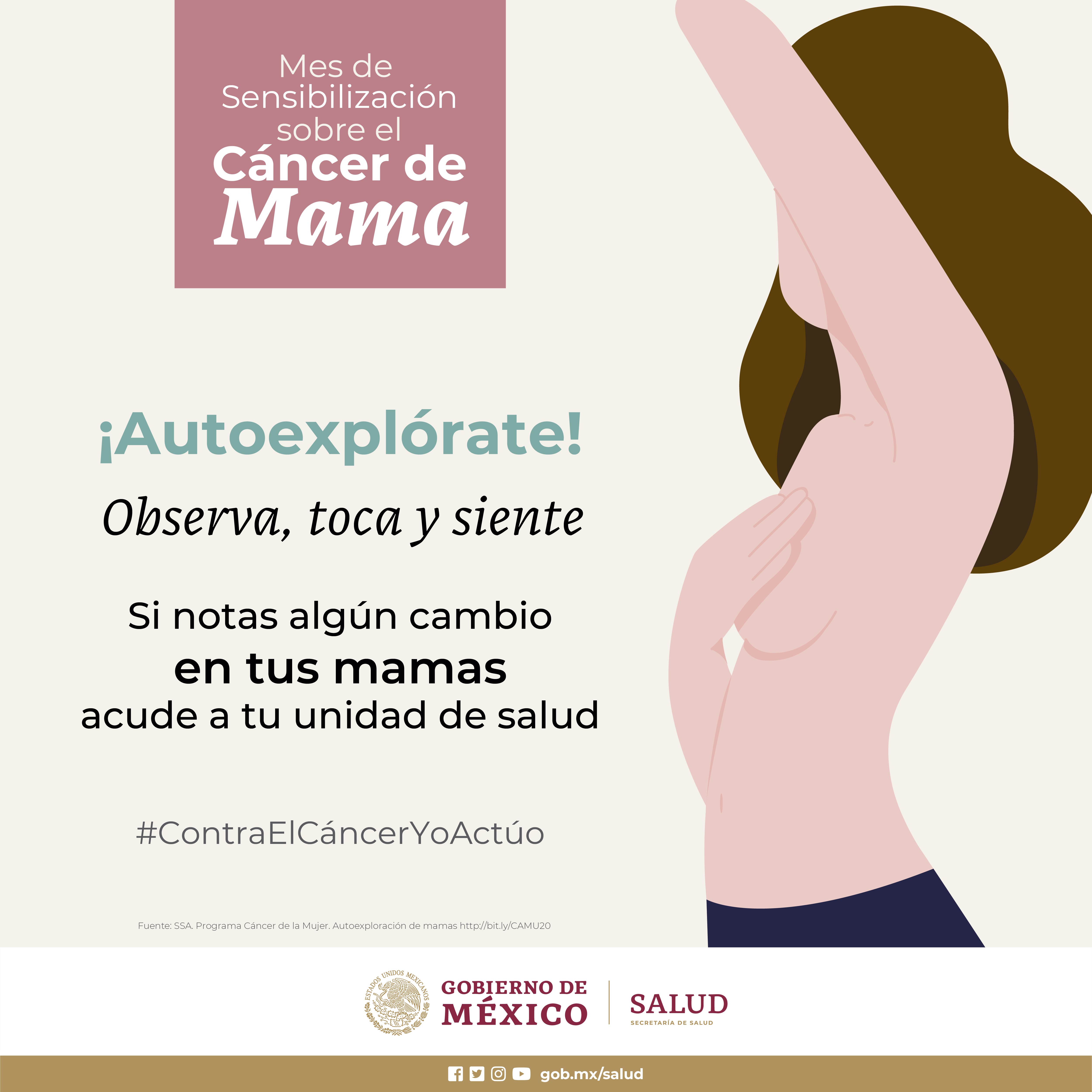 Prevención y detección oportuna fundamentales en control de cáncer de mama Secretaría de