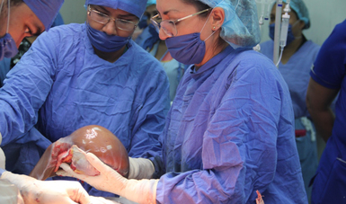 El corazón e hígado fueron trasladados al Hospital General de La Raza por especialistas del IMSS para ser trasplantados a derechohabientes; los riñones y córneas fueron enviados al Centro Médico Nacional Siglo XXI.