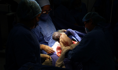 Foto de la bebé cargada por médicos especialistas que asistieron el nacimiento. 
