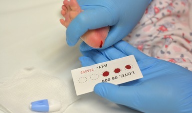 Amplía el ISSSTE de 6 a 66 la detección de enfermedades con tamiz neonatal metabólico en recién nacidos
