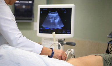 Se realizó drilling de ovario a la paciente, cirugía laparoscópica que sirve para estimular la ovulación espontánea.