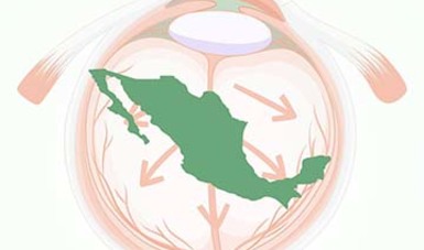 Ilustración de una cornea con la imagen de México.